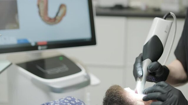 Doctor scans the patient's teeth in the clinic. The dentist holds in his hand a manual 3D scanner for the jaw and mouth. Dental health. Creates a 3D model of teeth and gums on a medical monitor.
