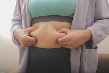 A woman shows an inflated thick belly, the concept of excess weight and weight loss