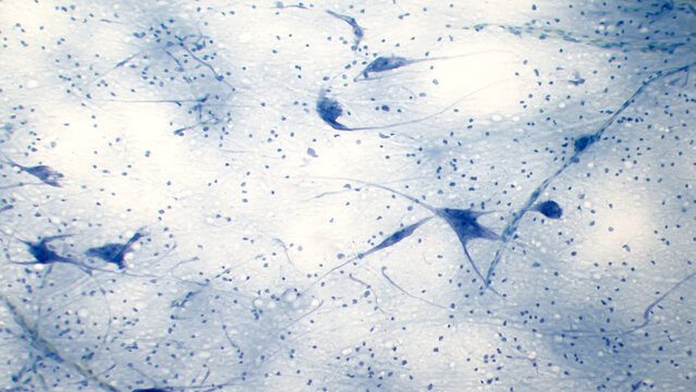 Pyramidal neurons. Pyramidal neurons. Spinal cord. Nissl stained.