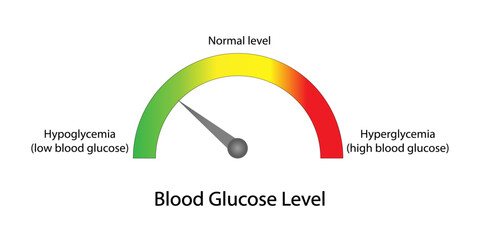 Blood Glucose Levels. Normal level, hypoglycemia (low blood sugar), hyperglycemia (high blood sugar), sugar test. vector diagram	