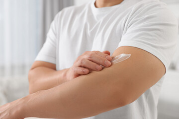 Man applying body cream onto his arm indoors, closeup