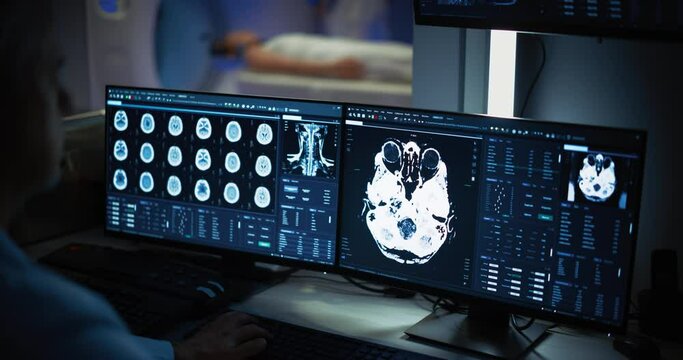 Medical Hospital Research Lab: Male Medical Scientist Using Computer with Brain Scan MRI Images of a Female Patient Undergoing Medical Process in the Background. Healthcare Service