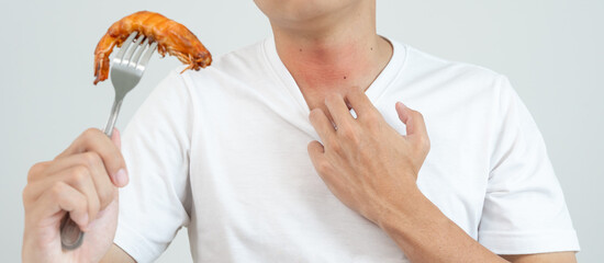food allergies, men have reactions itching and redness after eating shrimp, seafood allergy,...