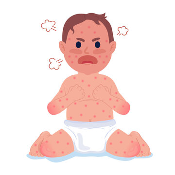 Crying baby with measles 2D cartoon character. Little child high fever isolated vector person white background. Chicken pox infant boy in diapers. Chickenpox symptom color flat spot illustration