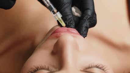 Close-up, woman's lips. A surgeon wearing medical gloves carefully and slowly injects hyaluronic...