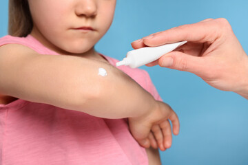 Mother applying ointment onto her daughter's elbow on light blue background, closeup