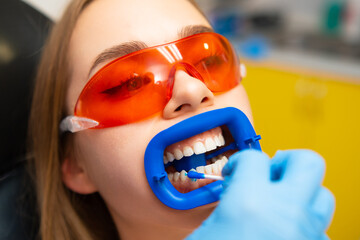 Dentist applies whitening gel to female patient, wearing orange protective goggles, teeth in the...