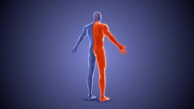 Hemiplegia paralysis condition medical concept