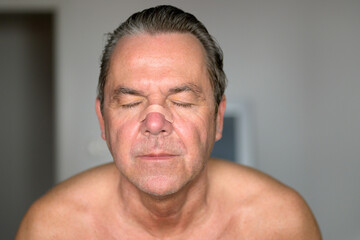 Portrait of a middle aged man with a nose tape and eyes closed