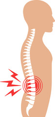 Illustration of back pain. Spine ache.