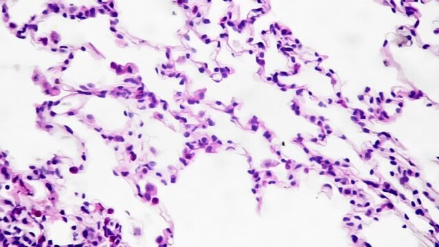 Macro footage of human bronchiolus in section filmed under microscope 400x on bright field background. Examining under microscope human respiratory system tissue. Process of respiration of people