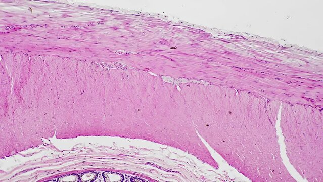 Section of human colon filmed under medical 100x microscope in scientific laboratory for healthcare check. Oncology screening of digestive system organ. Looking for tumor or other illness concept