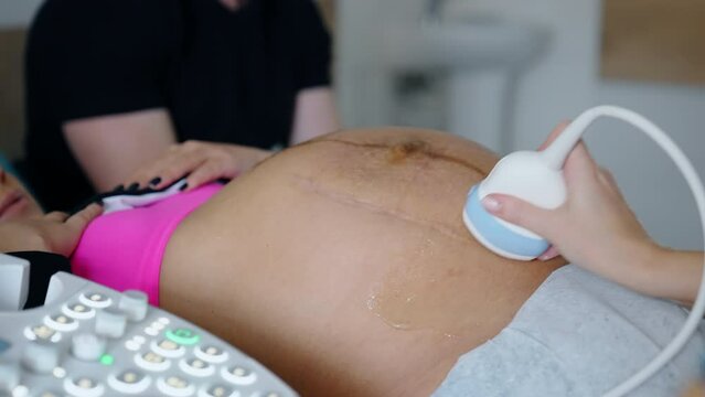 Cropped image of a pregnant lady on ultrasound check up. Doctor moves the device by the big abdomen.