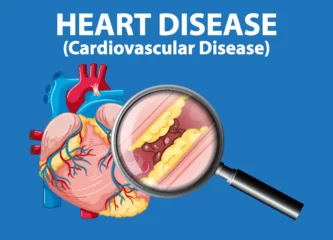 Fototapete Kinder Infographic on Sickness and Heart Disease in Medical Anatomy