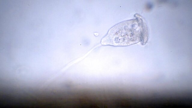 microscopic freshwater organisms, Vorticella, protozoa, phylum Ciliophora.