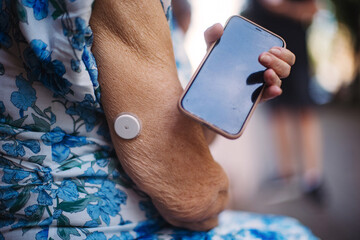 Close up of continuous glucose monitor sensor on arm connecting with smartphone.