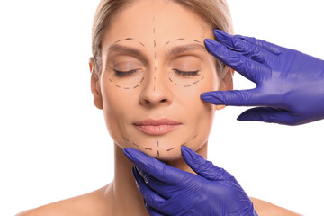 Doctor checking patient's face before cosmetic surgery operation on white background, closeup - obrazy, fototapety, plakaty