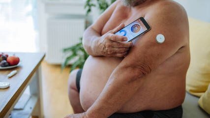 Close up of diabetic man using continuous glucose monitor to check blood sugar level.