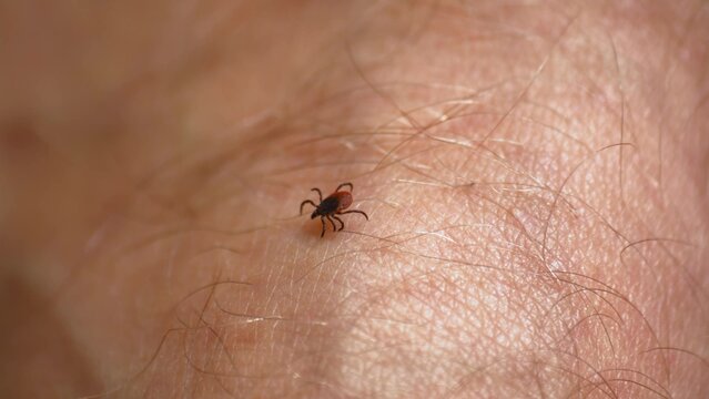 Tick Walking on Human Skin Seeking Place to Feed on Blood