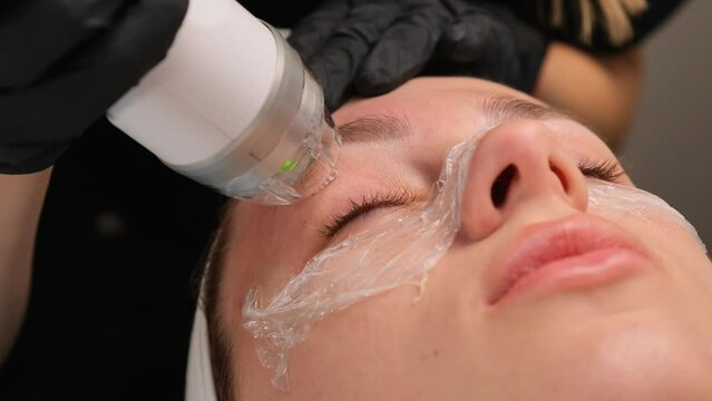 Close-up of a radiofrequency facelift procedure. Facial skin care, anti-aging facial rejuvenation. Radio wave face lifting in a cosmetology clinic. Close-up.
