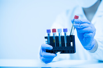 Woman medical technician holding blood tube in the research laboratory.Scientist hand taking blood sample tube from a rack with machines of analysis in laboratory.Professional equipment and test tube.