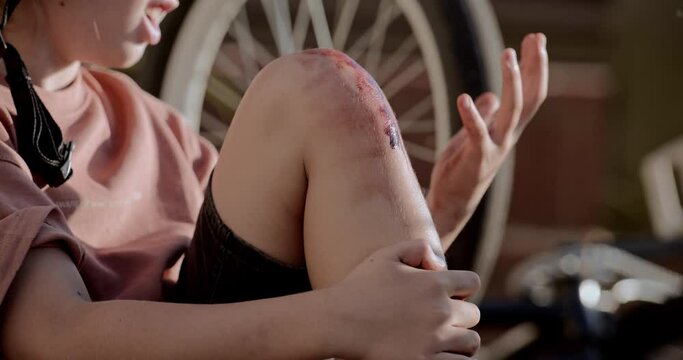 CU Kid checking his bleeding knee after falling from a bicycle while doing trick