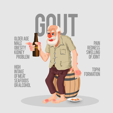 Old Person afflicted with Gout or Hyperuricemia sitting on a barrel of alcoholic beverage with some prawn for snacks.