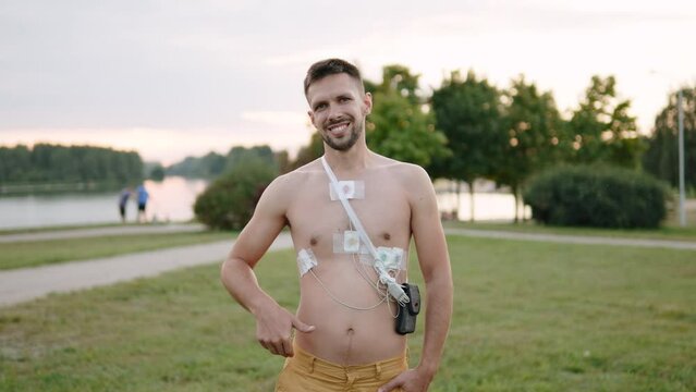 Confident slender man with holter monitor sensors on bare chest shows thumbs up at camera while standing in park, push in shot. Patient is satisfied with remote study of daily heart function.