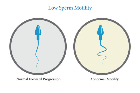 low sperm motility