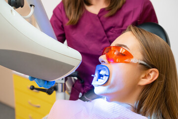 Teeth whitening for woman and application of UV lamp for bleaching teeth at dentist clinic - obrazy, fototapety, plakaty