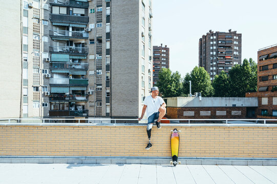 Young man with leg prosthesis sitting on railing in the city next to skateboard