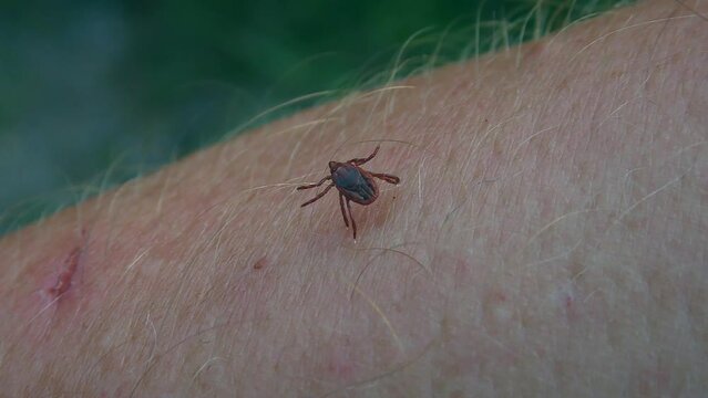 Hard tick or Scale tick (Ixodidae) crawls over human skin.