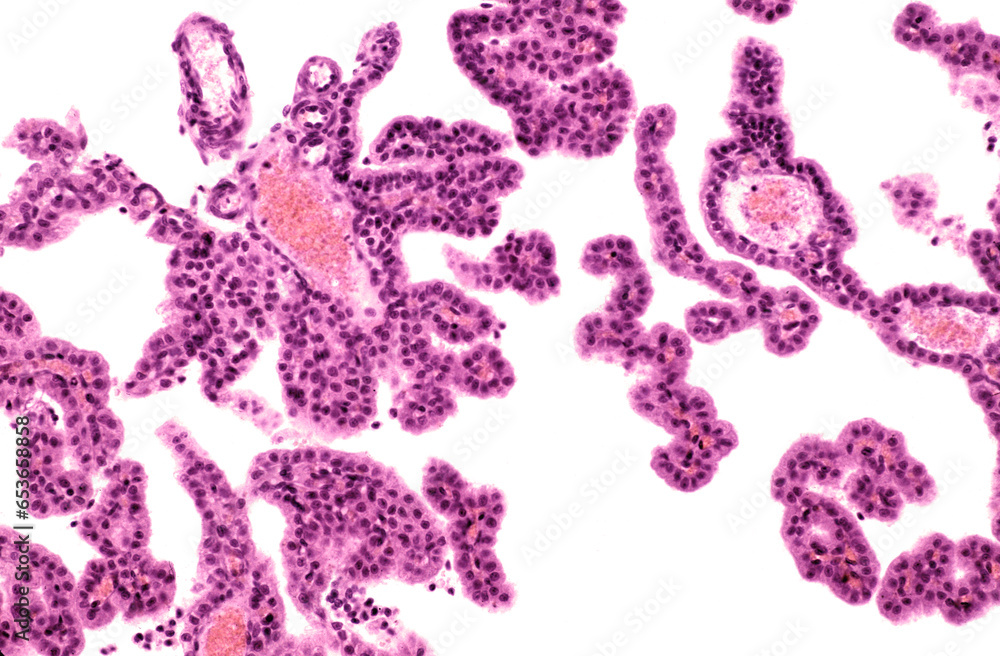 Poster Choroid plexus