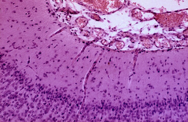 Cerebral cortex. Brain leptomeninges