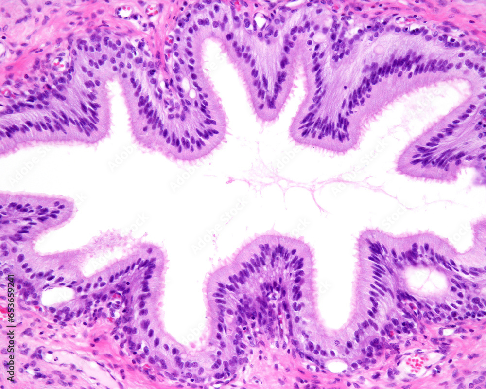 Poster vas deferens. pseudostratified epithelium