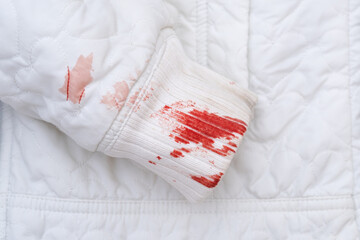 Blood stains on a white balloon jacket. daily life stain concept