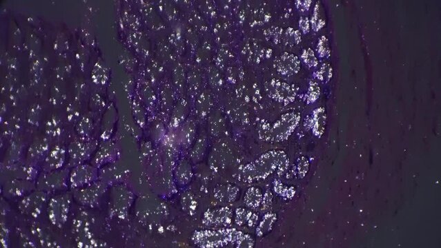 Piece of human rectum filmed with magnification 200x and cross light under microscope. Contrast macro view of intestine part investigated in medical laboratory during colonoscopy. Healthcare check