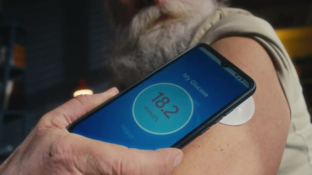 Close-up shot of anonymous elderly man with grey beard and moustache putting smartphone to blood sugar monitor patch on bare shoulder, checking with mobile app and getting dangerously high reading