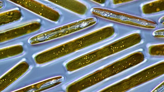 Diatom Pinnularia with oil droplets, a potential biofuel under the microscope. 