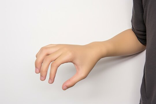 Cerebral palsy hand in Asian young male patient. Typically seen in hemiplegia and quadriplegia. Wrist joint flexion with ulnar deviation, Generative AI