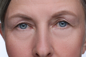 Senior woman with aging skin on white background, closeup. Rejuvenation treatment
