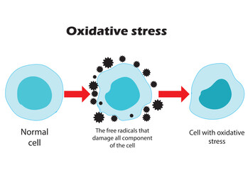Oxidative stress. From normal cells, to oxidative stress and aggressive free radicals, to cell death. Vector illustration. - obrazy, fototapety, plakaty