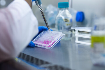 cell culture at the medicine, medical and biology laboratory, cancer science experiment at the...