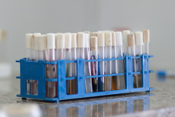 Container of test tubes with samples and labels