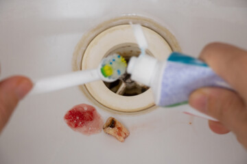 An extracted tooth with blood lies in the bathroom sink against the background of a toothbrush and...