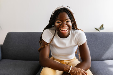 Smiling portrait of young african woman with vitiligo looking at camera sitting on sofa. Diversity,...