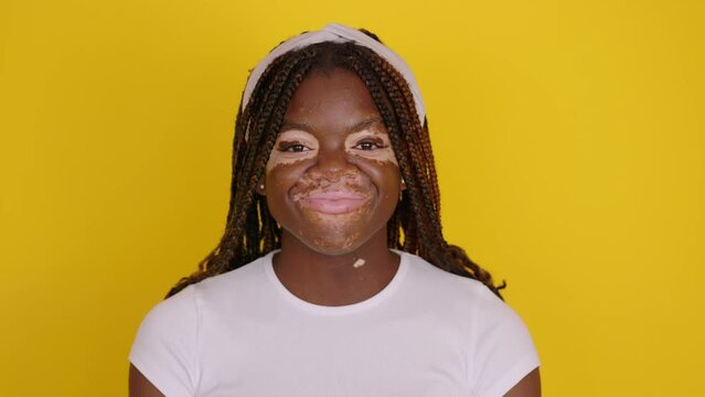 Isolated portrait of happy young african woman with vitiligo smiling at camera over yellow studio background.