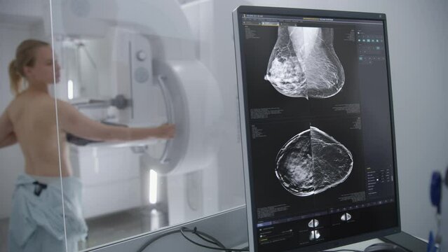 Adult woman stands topless undergoing mammography screening checkup in hospital radiology room. Computer control panel screen for activating mammogram machine. Breast cancer prevention. Modern clinic.