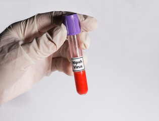 The picture shows a test tube with blood infected by the Nipah virus that is held in the hand of a...