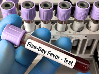 Blood sample for Trench fever also known as five-day fever and quintan fever test. It's a...
